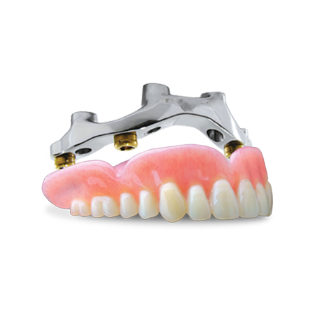Atlantis® Abutments thumbnail