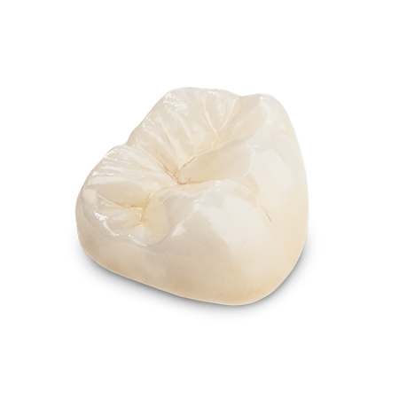 Full-Contour Zirconia thumbnail